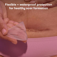 Silicone Scar Patches